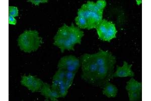 Immunofluorescence (IF) image for anti-ATPase, H+ Transporting, Lysosomal 42kDa, V1 Subunit C1 (ATP6V1C1) (AA 129-382) antibody (ABIN7175232)