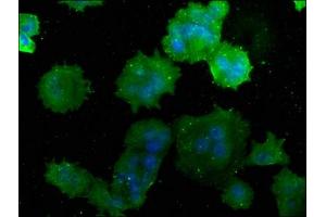 Immunofluorescence staining of MCF-7 cells with ABIN7175232 at 1:50, counter-stained with DAPI. (ATP6V1C1 抗体  (AA 129-382))