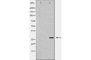 Western blot analysis of Hela  lysate, using U2AF1 antibody. (U2AF1 抗体  (Internal Region))