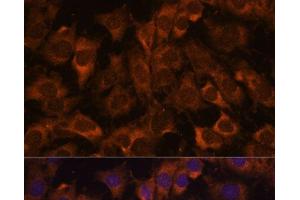 Immunofluorescence analysis of C6 cells using SEC23B Polyclonal Antibody at dilution of 1:100. (Sec23 Homolog B 抗体)