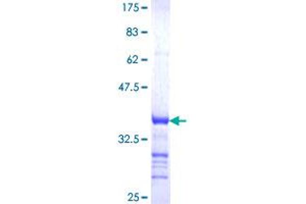 RUNX3 Protein (AA 194-279) (GST tag)