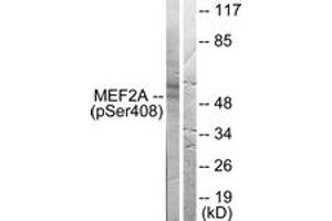 Western blot analysis of extracts from HeLa cells treated with PMA 125ng/ml 30', using MEF2A (Phospho-Ser408) Antibody. (MEF2A 抗体  (pSer408))