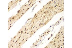 Immunohistochemistry of paraffin-embedded Human colon using CDX1 Polyclonal Antibody at dilution of 1:100 (40x lens). (CDX1 抗体)