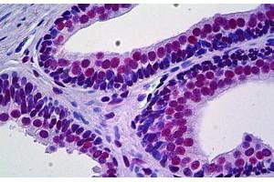 Human Prostate: Formalin-Fixed, Paraffin-Embedded (FFPE) (PRKDC 抗体  (AA 4019-4129))