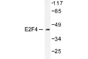 Image no. 1 for anti-E2F4/E2F5 (E2F4/5) antibody (ABIN265389) (E2F4/E2F5 (E2F4/5) 抗体)