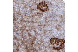 Immunohistochemical staining of human pancreas with LHFPL1 polyclonal antibody  shows strong cytoplasmic positivity in islet cells at 1:50-1:200 dilution. (LHFPL1 抗体)