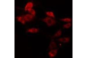 ABIN6275775 staining Hela cells by IF/ICC. (IFIT5 抗体  (Internal Region))