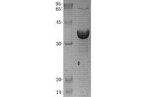 Validation with Western Blot (AKR1C4 Protein (His tag))