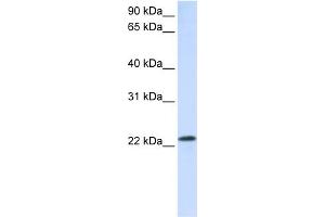WB Suggested Anti-RAB18 Antibody Titration:  0.
