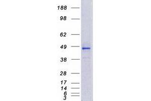 Western Blotting (WB) image for Cytochrome P450, Family 4, Subfamily F, Polypeptide 12 (CYP4F12) protein (Myc-DYKDDDDK Tag) (ABIN2712781)
