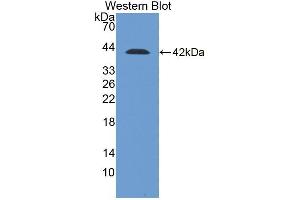 Detection of Recombinant DSC2, Human using Polyclonal Antibody to Desmocollin 2 (DSC2) (Desmocollin 2 抗体  (AA 136-471))