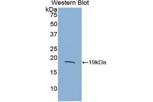 Western blot analysis of the recombinant protein. (RNASE3 抗体  (AA 33-155))