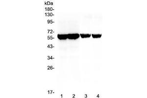 Western blot testing of different lots of mouse testis lysate (lanes 1, 2) and rat testis lysate (lanes 3, 4) with Cyp17a1 antibody at 0. (CYP17A1 抗体  (AA 80-363))