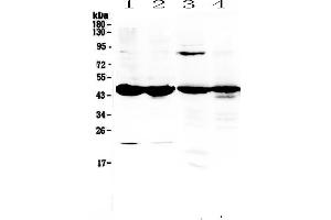 Western blot analysis of ADA using anti-ADA antibody . (ADA 抗体  (AA 2-241))