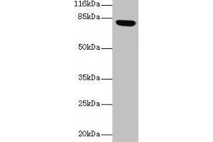 Western blot All lanes: Lhcgr antibody at 2 μg/mL + Rat gonadal tissue Secondary Goat polyclonal to rabbit IgG at 1/10000 dilution Predicted band size: 79, 35, 38, 73, 28, 33, 21, 72, 31, 34, 41 kDa Observed band size: 79 kDa (LHCGR 抗体  (AA 27-362))