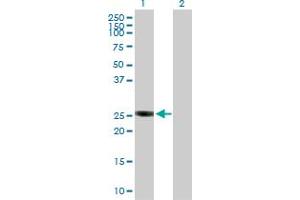Western Blot analysis of GSTO2 expression in transfected 293T cell line by GSTO2 MaxPab polyclonal antibody. (GSTO2 抗体  (AA 1-243))
