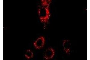 Immunofluorescent analysis of p43 staining in HepG2 cells. (p43 抗体)