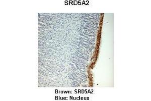 Sample Type :  Monkey adrenal gland   Primary Antibody Dilution :   1:25   Secondary Antibody:  Anti-rabbit-HRP   Secondary Antibody Dilution:   1:1000   Color/Signal Descriptions:  Brown: SRD5A2 Blue: Nucleus   Gene Name:  SRD5A2   Submitted by:  Jonathan Bertin, Endoceutics Inc. (SRD5A2 抗体  (N-Term))