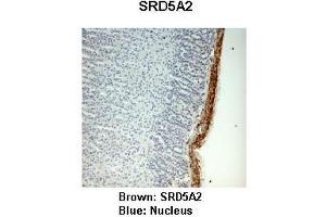 Immunohistochemistry (IHC) image for anti-Steroid-5-alpha-Reductase, alpha Polypeptide 2 (3-Oxo-5 alpha-Steroid delta 4-Dehydrogenase alpha 2) (SRD5A2) (N-Term) antibody (ABIN2781788)