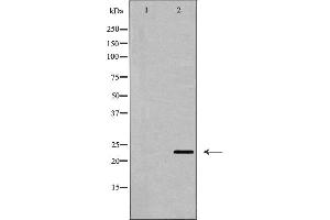 Western blot analysis of CD69 expression in Jurkat cell lysate,The lane on the left is treated with the antigen-specific peptide. (CD69 抗体  (Internal Region))