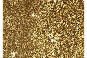 Immunohistochemistry (IHC) image for anti-Inhibitor of kappa Light Polypeptide Gene Enhancer in B-Cells, Kinase epsilon (IKBKE) (C-Term) antibody (ABIN6262509)