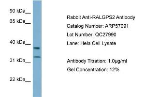 Western Blotting (WB) image for anti-Ral GEF with PH Domain and SH3 Binding Motif 2 (RALGPS2) (N-Term) antibody (ABIN2787055)