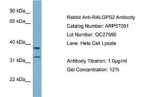 WB Suggested Anti-RALGPS2  Antibody Titration: 0. (RALGPS2 抗体  (N-Term))