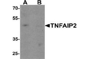 Western blot analysis of TNFAIP2 in K562 cell lysate with TNFAIP2 Antibody  at 1 ug/ml in (A) the absence and (B) the presence of blocking peptide. (TNFAIP2 抗体  (Middle Region))