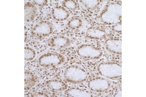 Immunohistochemistry (IHC) image for anti-ElaC Homolog 2 (ELAC2) (AA 776-826) antibody (ABIN7455054)