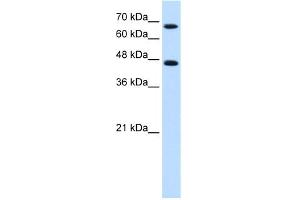 WB Suggested Anti-NR4A2 Antibody Titration:  0. (NR4A2 抗体  (C-Term))