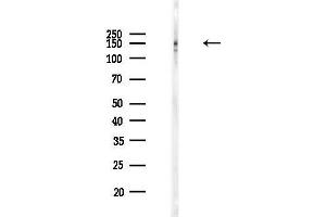Western blot analysis of lysates from Rat brain, using PDS5B Antibody at 1/1000 dilution.