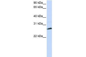 WB Suggested Anti-SYCP3 Antibody Titration: 0. (SYCP3 抗体  (N-Term))