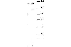 AIB1 antibody (pAb) tested by Western blot. (NCOA3 抗体)