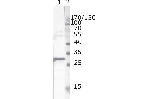 Western Blot testing of HIV-1 recombinant Nef protein. (HIV-1 Nef (AA 163-173) 抗体)