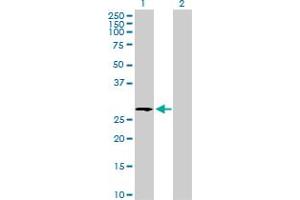 Western Blot analysis of UGCGL2 expression in transfected 293T cell line by UGCGL2 MaxPab polyclonal antibody. (UGCGL2 抗体  (AA 1-278))