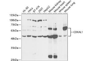 Western blot analysis of extracts of various cell lines, using CDK antibody (ABIN6131010, ABIN6138333, ABIN6138334 and ABIN6221451) at 1:1000 dilution. (CDKAL1 抗体  (AA 1-230))
