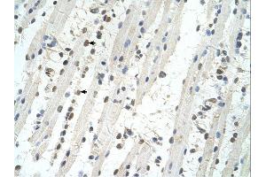Immunohistochemistry (IHC) image for anti-Tripartite Motif Containing 32 (TRIM32) (C-Term) antibody (ABIN309924) (TRIM32 抗体  (C-Term))