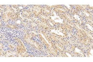 Detection of HIF2a in Human Kidney Tissue using Polyclonal Antibody to Hypoxia Inducible Factor 2 Alpha (HIF2a) (EPAS1 抗体  (AA 26-347))