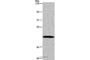 Western blot analysis of Human hepatocellular carcinoma tissue, using CYP1A2 Polyclonal Antibody at dilution of 1:440 (CYP1A2 抗体)