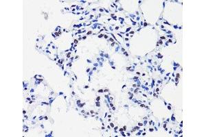 Immunohistochemistry of paraffin-embedded Rat lung using Acetyl-Histone H2B-K15 Polyclonal Antibody at dilution of 1:100 (40x lens). (Histone H2B 抗体  (acLys15))