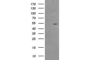 HEK293T cells were transfected with the pCMV6-ENTRY control (Left lane) or pCMV6-ENTRY AP2M1 (Right lane) cDNA for 48 hrs and lysed. (AP2M1 抗体  (AA 97-383))