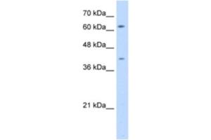 Western Blotting (WB) image for anti-SWAP Switching B-Cell Complex 70kDa Subunit (SWAP70) antibody (ABIN2462957) (SWAP70 抗体)