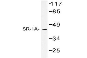 Image no. 1 for anti-Serotonin Receptor 1A (HTR1A) antibody (ABIN272268) (Serotonin Receptor 1A 抗体)