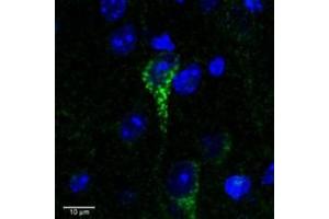 Image no. 4 for anti-Corticotropin Releasing Hormone Receptor 1 (CRHR1) (AA 107-117) antibody (ABIN238557)