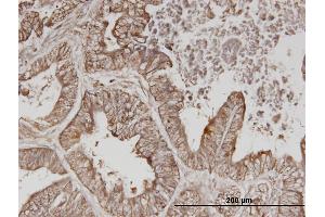 Immunostaining (ISt) image for anti-Receptor Tyrosine-Protein Kinase ErbB-3 (ERBB3) (AA 21-331) antibody (ABIN515375)