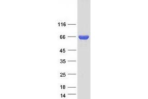 Western Blotting (WB) image for Coiled-Coil Domain Containing 99 (CCDC99) protein (Myc-DYKDDDDK Tag) (ABIN2732590)