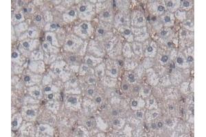 Detection of HCII in Human Liver Tissue using Polyclonal Antibody to Heparin Cofactor II (HCII)