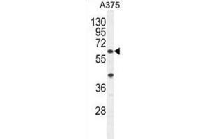 Western Blotting (WB) image for anti-APOBEC1 Complementation Factor (A1CF) antibody (ABIN2995767) (A1CF 抗体)