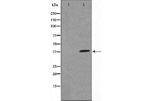 Western blot analysis of IkappaB-alpha expression in TNF-α treated MCF7 whole cell lysates,The lane on the left is treated with the antigen-specific peptide. (NFKBIA 抗体  (N-Term))