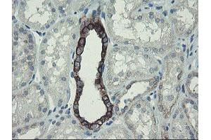 Image no. 11 for anti-Diphthamide Biosynthesis Protein 2 (DPH2) antibody (ABIN1497891)